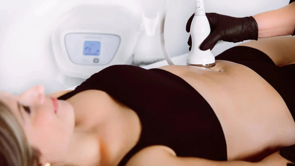 Cliënt ondergaat een Cryo 4 vetbevriezingsbehandeling bij Sa Baran PMU-Beauty-Academy.