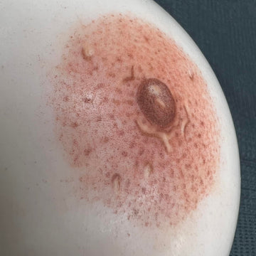 3D Areola – SA Baran PMU